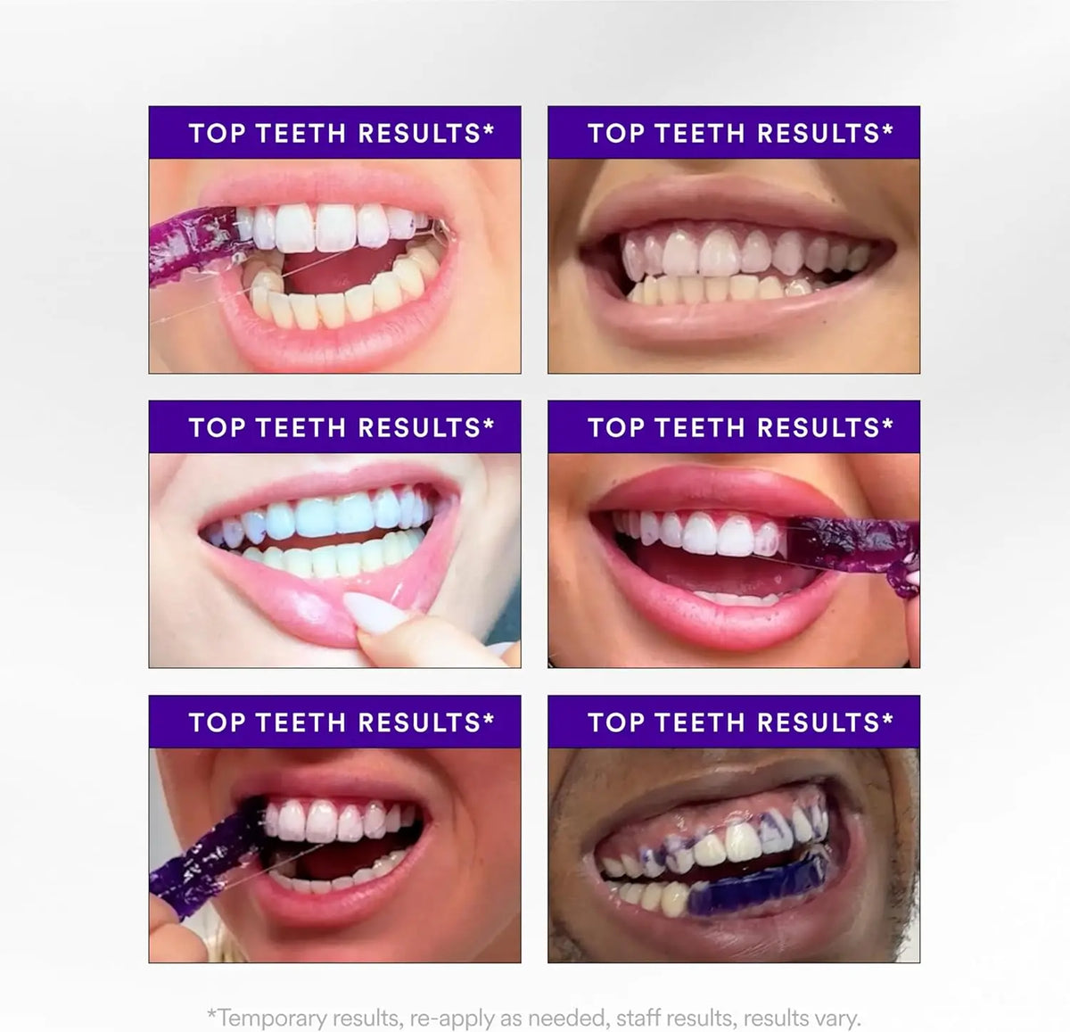 Hismile V34 Whitening Strips