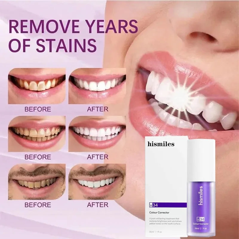 Hismile V34 Colour Corrector Serum